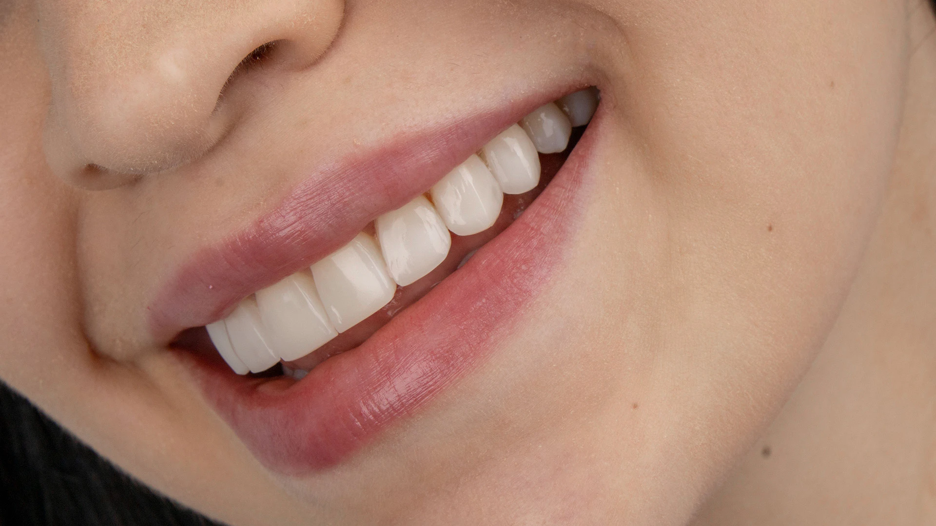 Natural smile viewed from the side