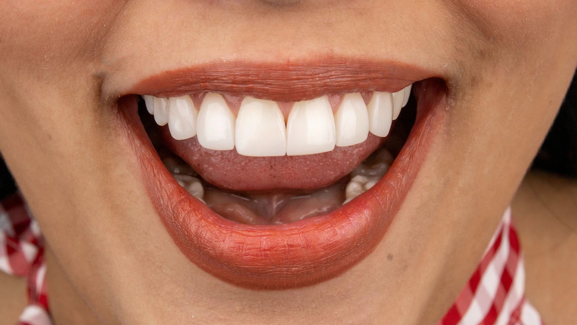 Bright smile with cosmetic dental work