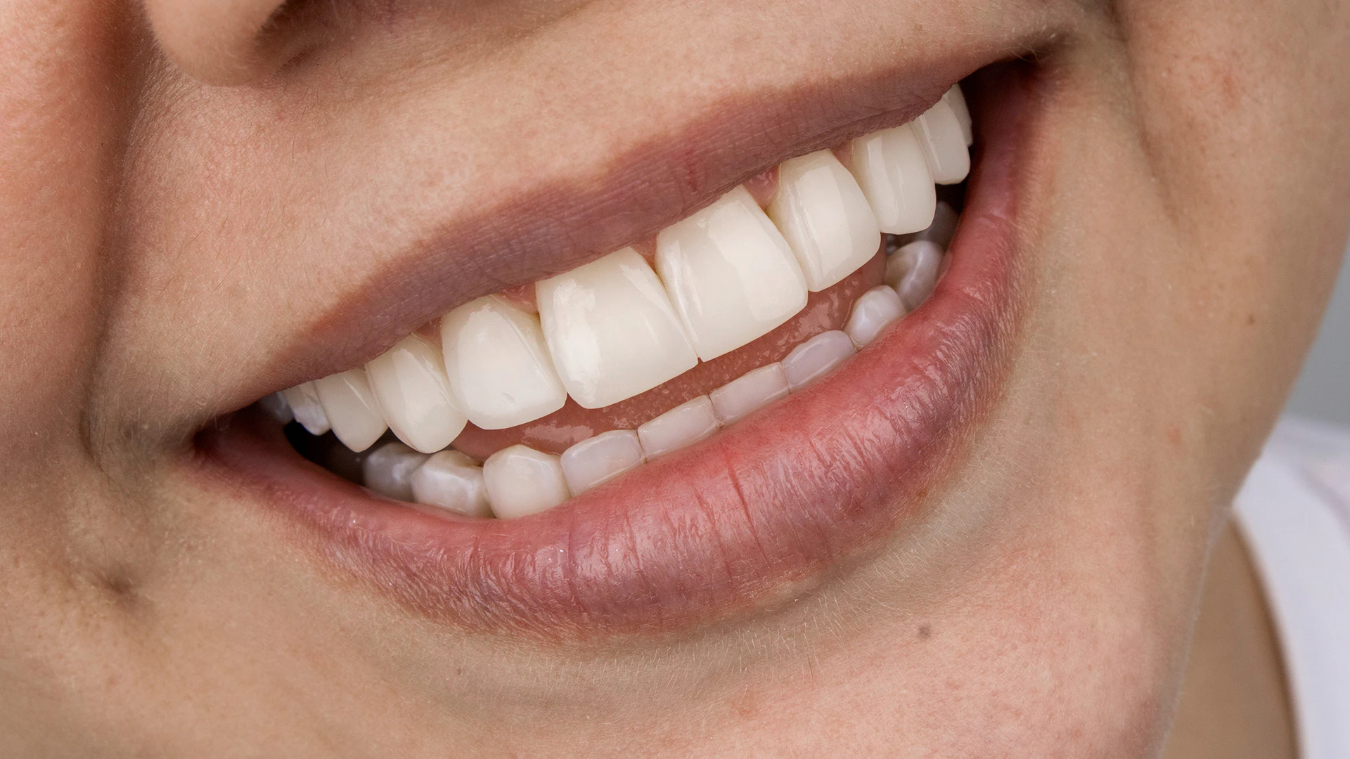 Close-up of a natural smile